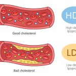 Cholesterol diet Malta - healthy foods recommended by a nutritionist
