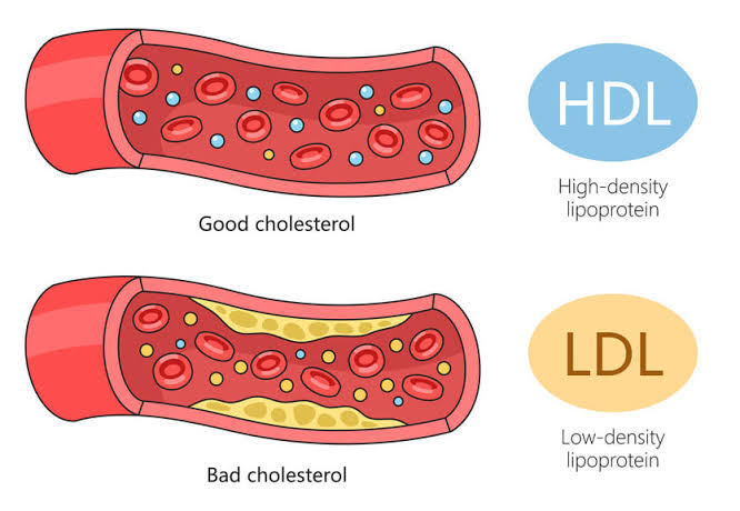 Cholesterol diet Malta - healthy foods recommended by a nutritionist